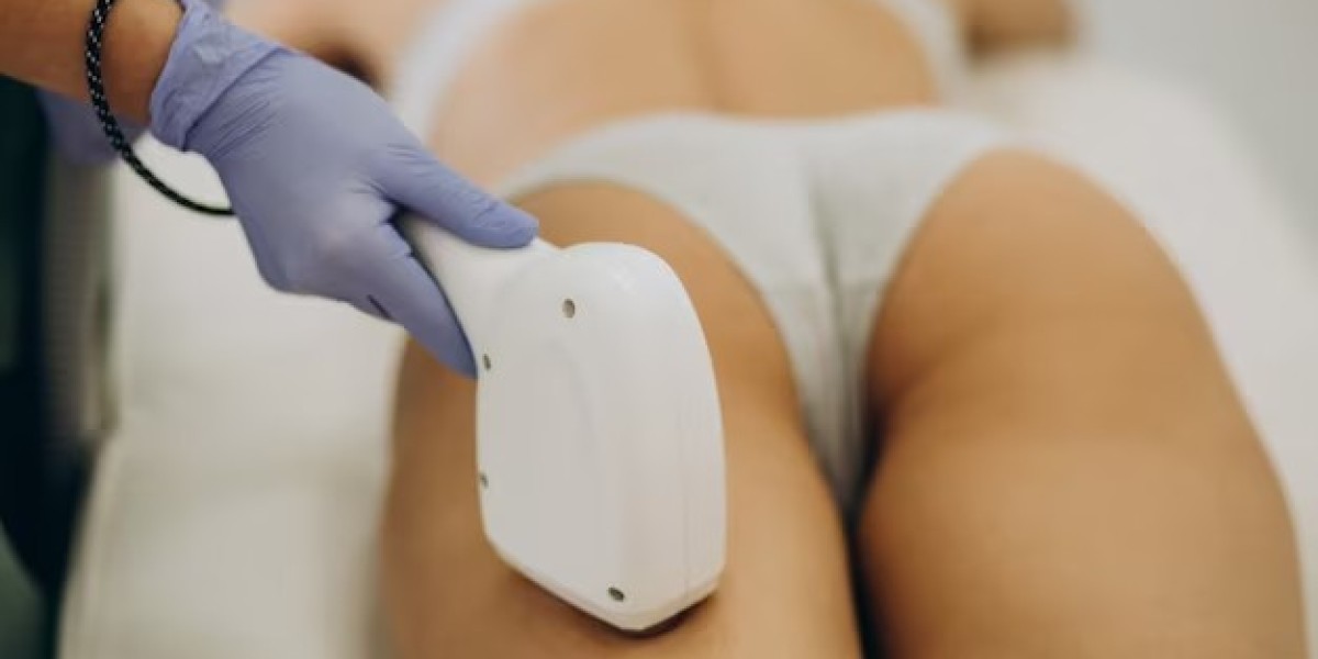 Beverly Hills Med Spa: Transform with Ultrasound Cavitation