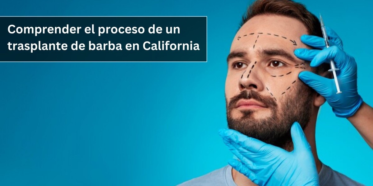 Understanding the Process of a Beard Transplant in California